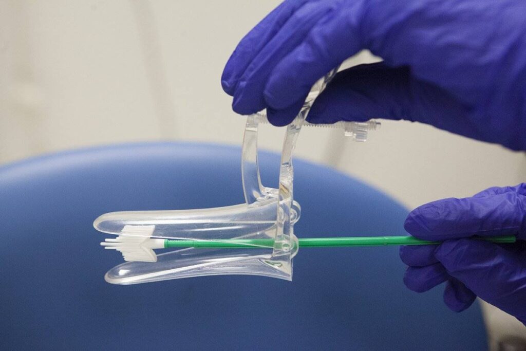 پاپ اسمیر چیست و چه کسانی